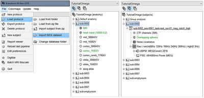 Brainstorm Pipeline Analysis of Resting-State Data From the Open MEG Archive